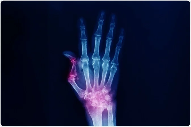 Rheumatology